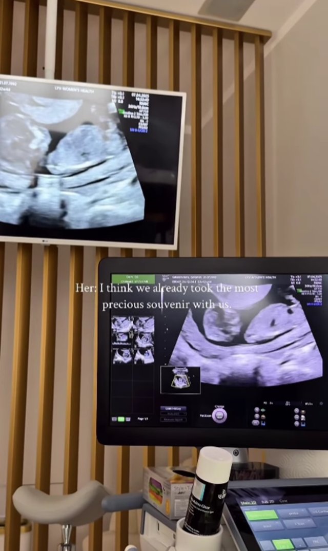Primele imagini cu burtica de gravidă a lui Carmen Grebenișan. A anunțat că este însărcinată în patru luni la un an de la divorț. Va deveni mamă pentru prima oară la 32 de ani