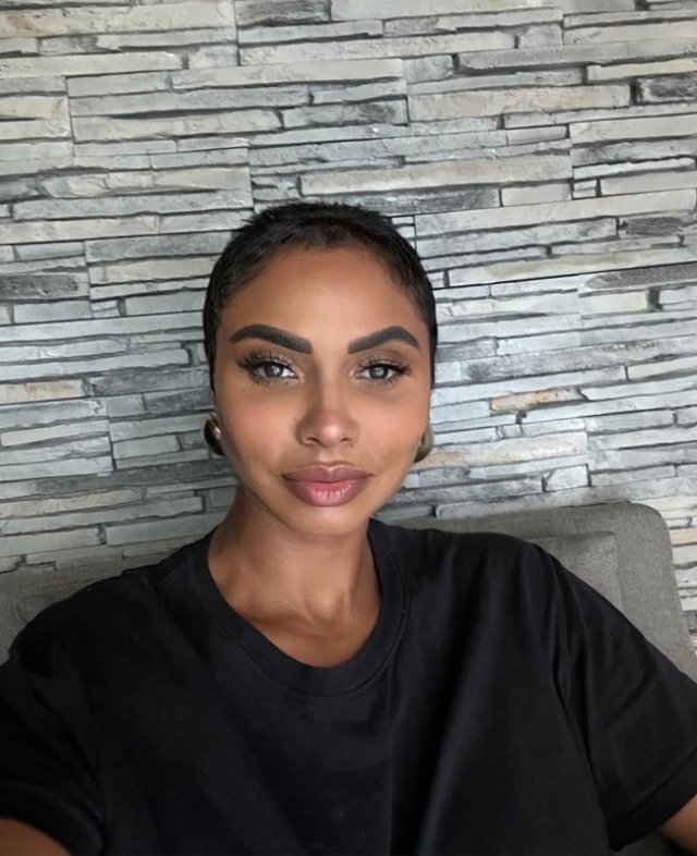 Laurette a trecut prin clipe de coșmar după ce a ajuns imobilizată la pat. Ce dezvăluiri șocante a făcut despre procedura estetică care i-a pus în pericol viața. Substanța a migrat și a provocat o infecție