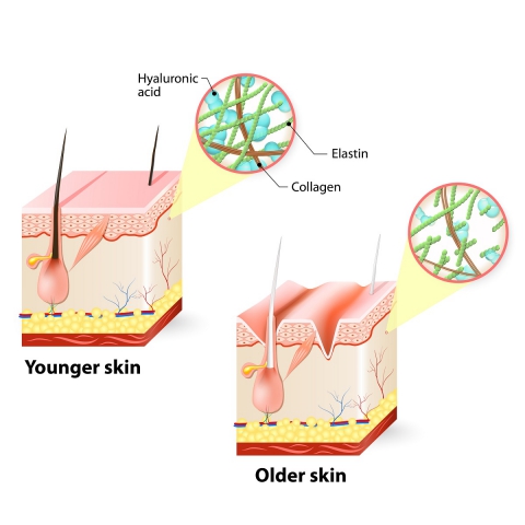 3. Acid hialuronic