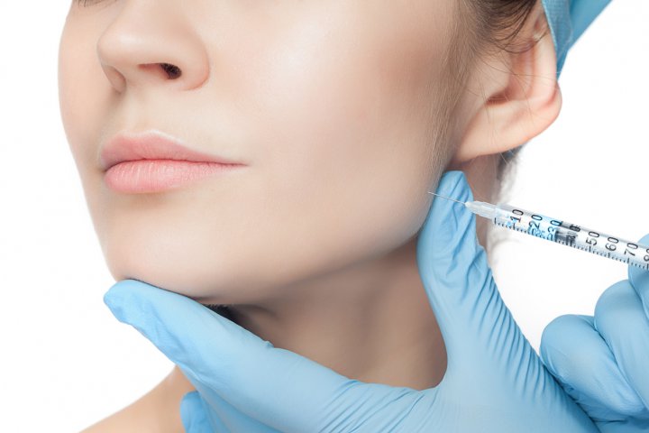 Microneedling