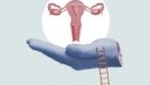 Transplantul de uter in România? Cazuri, costuri și riscuri