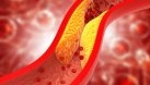 Colesterolul redus într-o săptămână. Cinci pași recomandați de nutriționiști