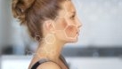 Ce este melasma și de ce apare în sarcină