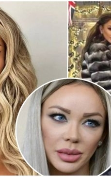Cum arată Bianca Drăgușanu după ce și-a făcut 'cat eyes' chirurgical. S-a filmat când medicul i-a cusut pleoapele 