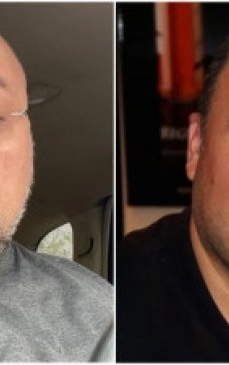 Gogoașă din ”Trăsniții NATO” tot mai aproape de sfârșit! Actorul se luptă cu aceeași boală care a răpus-o pe Rona Hartner! ”Să mai prind măcar 5 ani”