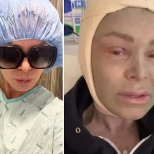 Doamne ferește! Una dintre cele mai frumoase femei din televiziune a ajuns de nerecunoscut din cauza operațiilor estetice! Cele mai recente imagini cu ea sunt greu de văzut!