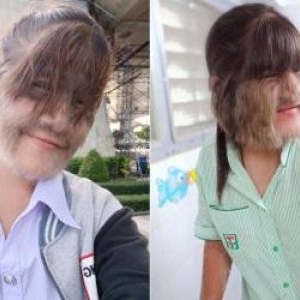 Cazul inedit al celei mai păroase femei din lume. Cum arată acum după ce s-a căsătorit și și-a îndepărtat tot părul