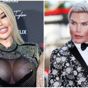 Jessica Alves, de nerecunoscut după ce a apelat a șasea oară la lifting facial. În ce ipostază a fost văzut fostul bărbat Ken