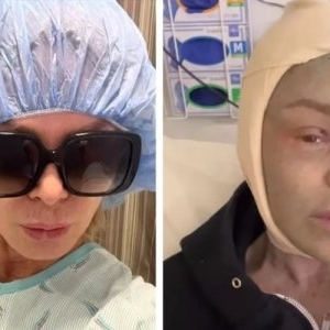 Se număra printre frumusețile din lumea televiziunii, dar a ajuns de nerecunoscut din cauza operațiilor estetice: „Abia deschid ochii” Imaginile de acum cu ea sunt tulburătoare și mulți au crezut că e o glumă